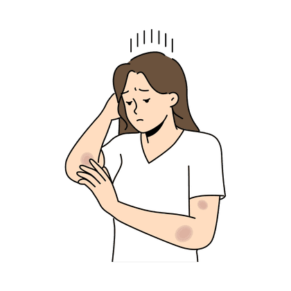 Hematoma, hematoma, contusión