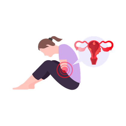 Fibromi uterini