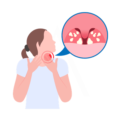 Angina e tonsillite