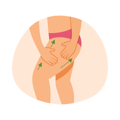 Celulitis