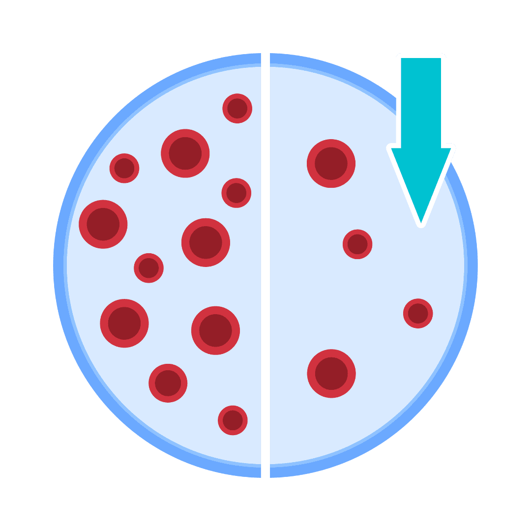 Anemia (falta de hierro)